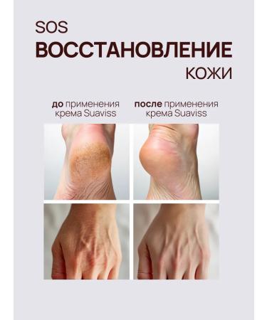 SUAVISS Cream of body wax from cracks and dryness delicate heels 100 ml - Buy Online on GoSupps.com
