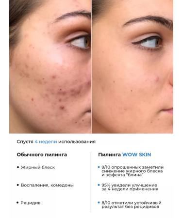 Just Cosmetics Salicyl pilling from acne and inflammation - Buy Online on GoSupps.com