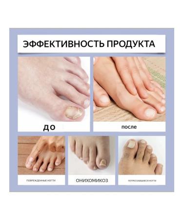 Remedy for nail fungus on the arms and legs 15 ml - Buy Online on GoSupps.com