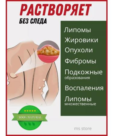 TOWN UDOKI 06 Ointment from Lipoma and Girovikov 20 g - Buy Online on GoSupps.com