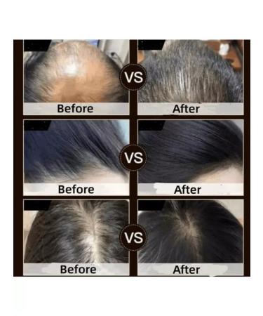 Aida Beauty Shampoo to strengthen hair from falling with green tea - Buy Online on GoSupps.com