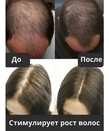 WELEDA Strengthening tonic with rosemary for hair growth 100 ml - Buy Online on GoSupps.com