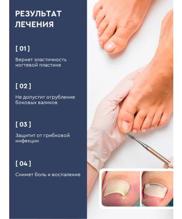 INKI Softener for ingrown nails on the legs and arms 30 ml - Buy Online on GoSupps.com