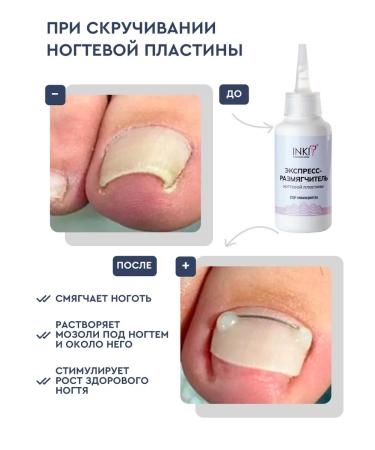 INKI Softener from ingrown nails on the legs and arms 100 ml - Buy Online on GoSupps.com