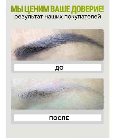 Golden Lines Remover amplifier for removing permanent and tattooing - Buy Online on GoSupps.com