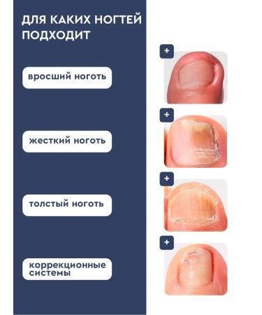 INKI Emulsion and serum of softening an ingrown nail - Buy Online on GoSupps.com