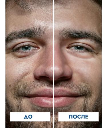 Chic Woman Male moisturizing anti -aging face - Buy Online on GoSupps.com