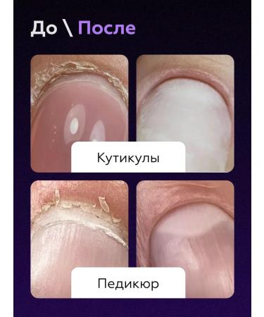 NATURA ANMOVELY Manicure scissors for cuticle Professional - Buy Online on GoSupps.com