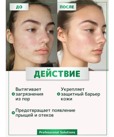 Dr Proffi Facial mask cleansing with zinc 60 ml - Buy Online on GoSupps.com