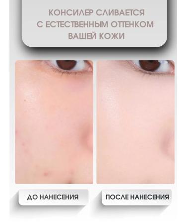 ABOUT TONE Classile for the face and eyes are dense natural - Buy Online on GoSupps.com