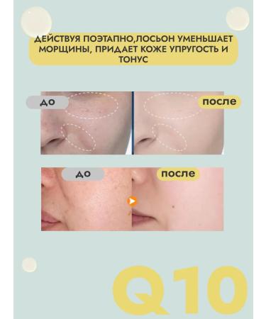 THE:BO Moisturizer Creamline Cream with Coenzym Q10 - Buy Online on GoSupps.com