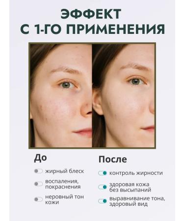 THE:BO Facial toner for acne - Buy Online on GoSupps.com