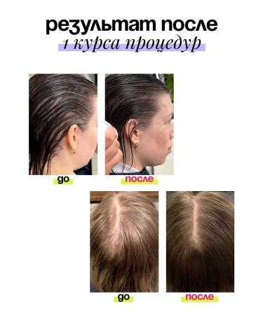 Sointera Hair growth and strengthening tonic - Buy Online on GoSupps.com