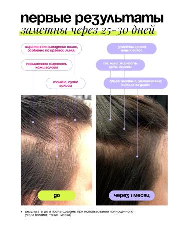 Sointera Contractor mask stimulating for hair growth - Buy Online on GoSupps.com