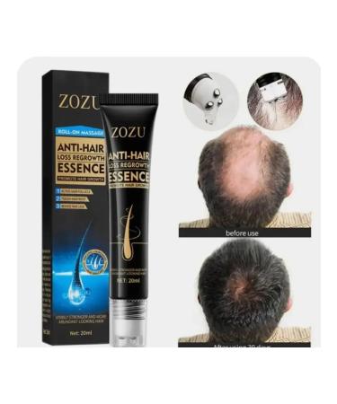 Zozu Anti-hair loss serum - Buy Online on GoSupps.com