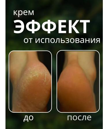 AsiaEssense Cream for face and body moisturizing and bleaching 100 ml - Buy Online on GoSupps.com