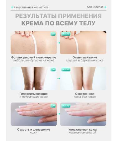 AsiaEssense Cream for face and body moisturizing and bleaching 100 ml - Buy Online on GoSupps.com