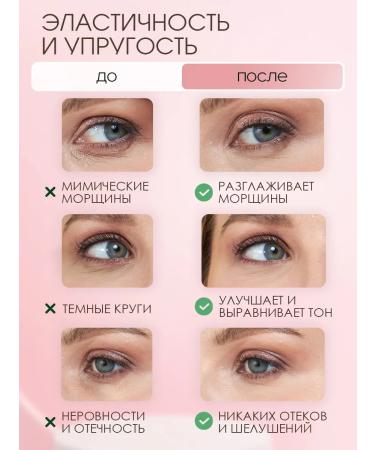 My world Patches for the eyes from edema and bags of circles anti -aging circles - Buy Online on GoSupps.com