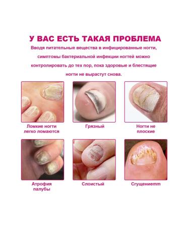 Ouhoe Essence for the treatment of nails with ginger - Buy Online on GoSupps.com