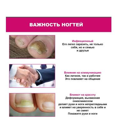 Ouhoe Essence for the treatment of nails with ginger - Buy Online on GoSupps.com