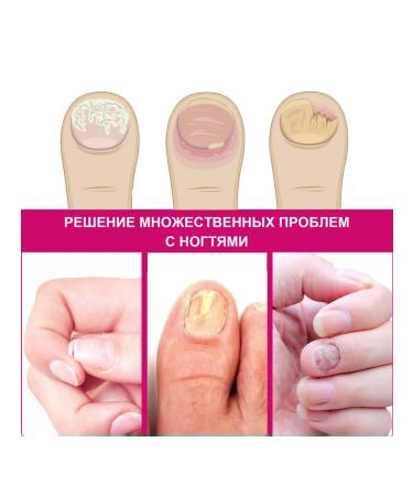 Ouhoe Essence for the treatment of nails with ginger - Buy Online on GoSupps.com