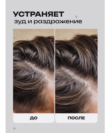 lvcos Hair shampoo from dandruff serum - Buy Online on GoSupps.com