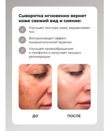 VT Cosmetics Serum VT Reedle Shot 100 - Buy Online on GoSupps.com