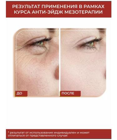 Matrigen Facial serum with vitamin C - Buy Online on GoSupps.com