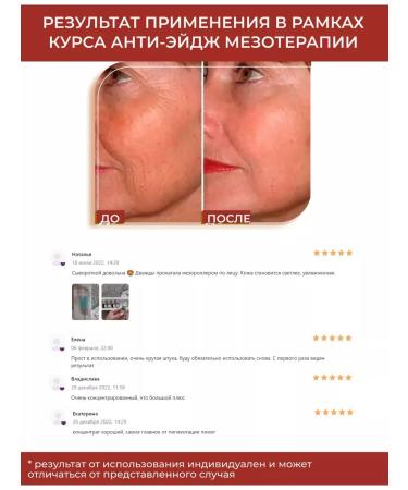 Matrigen Facial serum with vitamin C - Buy Online on GoSupps.com