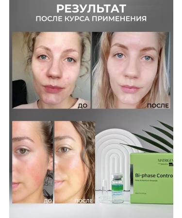 Matrigen Wheezero for the face. Antistress and moisture - Buy Online on GoSupps.com