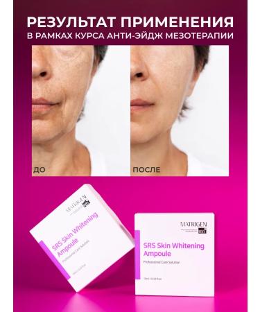 Matrigen Wedeously for the face and body. From pigmentation whitening - Buy Online on GoSupps.com