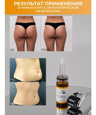 Matrigen Herbity for the body. From cellulite. Fat. 10 ml - Buy Online on GoSupps.com