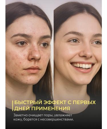 Holy Dew Hydrophilic facial oil from acne moisturizer 150 ml - Buy Online on GoSupps.com