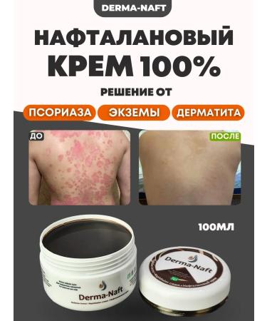 DERMANAFT Cream from psoriasis of atopic dermatitis of eczema neurodermatitis - Buy Online on GoSupps.com