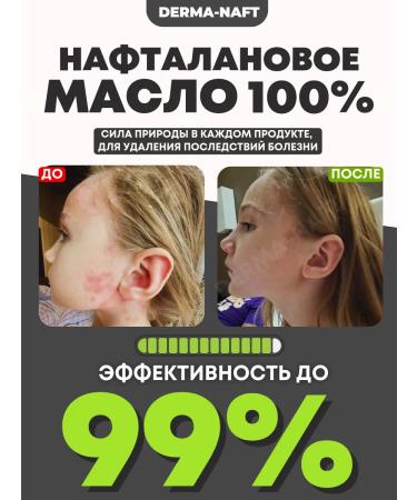 DERMANAFT Oil from psoriasis and seborrhea naphthalan - Buy Online on GoSupps.com