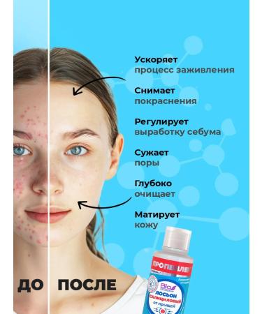 PROPELLER Salicylic pimples for oily skin 100ml - Buy Online on GoSupps.com