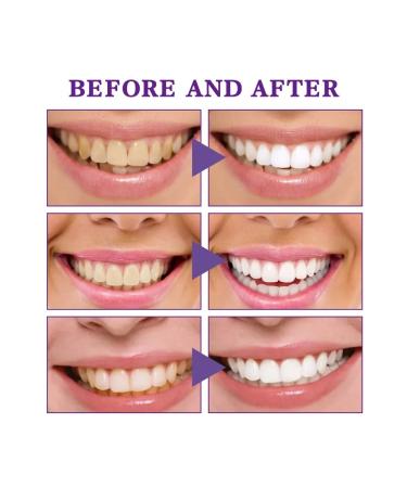 West & Month V34 bleaching toothpaste - Buy Online on GoSupps.com