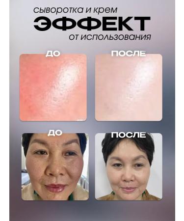 AsiaEssense Set of whitening serum for the face 2 pcs - Buy Online on GoSupps.com