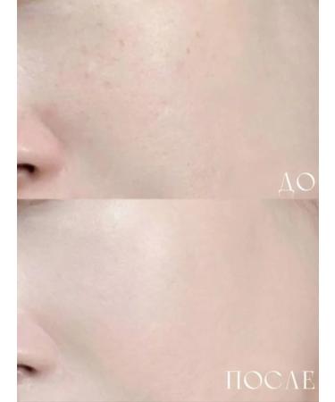 Clio Kushon with Kill Cover Skin Fixer Cushion 23 N Ginger - Buy Online on GoSupps.com