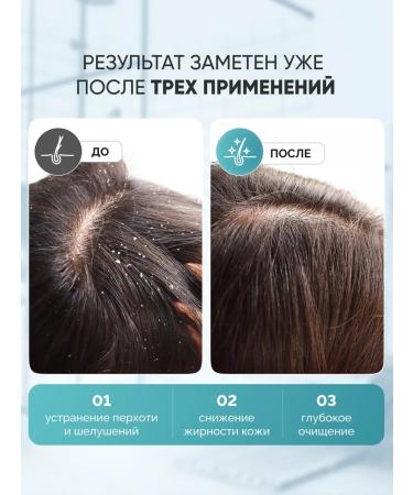 ISSANCE Laboratory Cleaning mask-peeling for the head and against dandruff 200 ml - Buy Online on GoSupps.com
