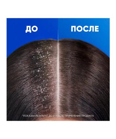 Head&Shoulders Citrus Fresh shampoo 600ml - Buy Online on GoSupps.com