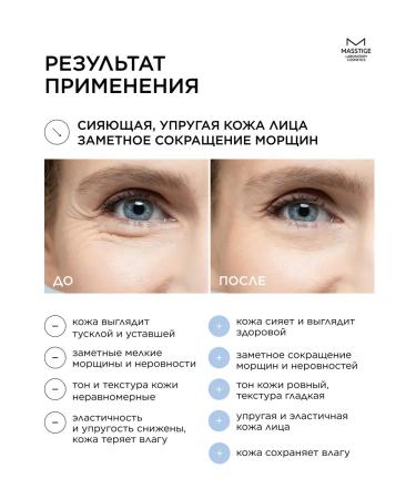 MASSTIGE Antioxidant Facial serum with vitamin C 30ml - Buy Online on GoSupps.com