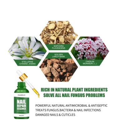 West & Month Nail products from fungus China 30 ml - Buy Online on GoSupps.com