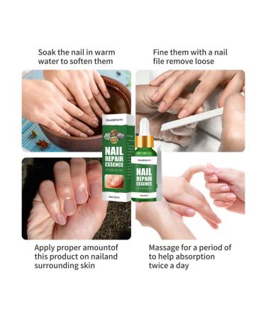 West & Month Nail products from fungus China 30 ml - Buy Online on GoSupps.com