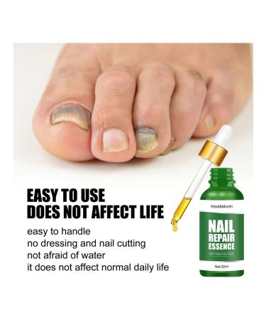 West & Month Nail products from fungus China 30 ml - Buy Online on GoSupps.com