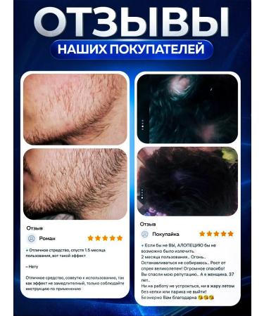 Vikinord Vikonord 5% lotion for hair growth and beard + Mesoroller - Buy Online on GoSupps.com