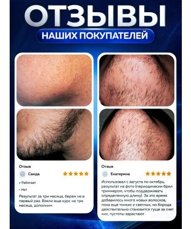 Vikinord Vikonord 5% lotion for hair growth and beard + Mesoroller - Buy Online on GoSupps.com