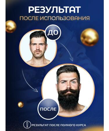 Vikinord Activator 15% for hair growth and beard + mesoroller - Buy Online on GoSupps.com