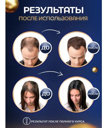 Vikinord Mega-Buster 15% (2 pcs) for hair growth + Mesoroller - Buy Online on GoSupps.com