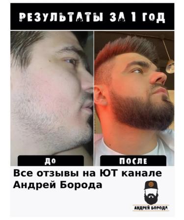 Hair and beard growth - Buy Online on GoSupps.com